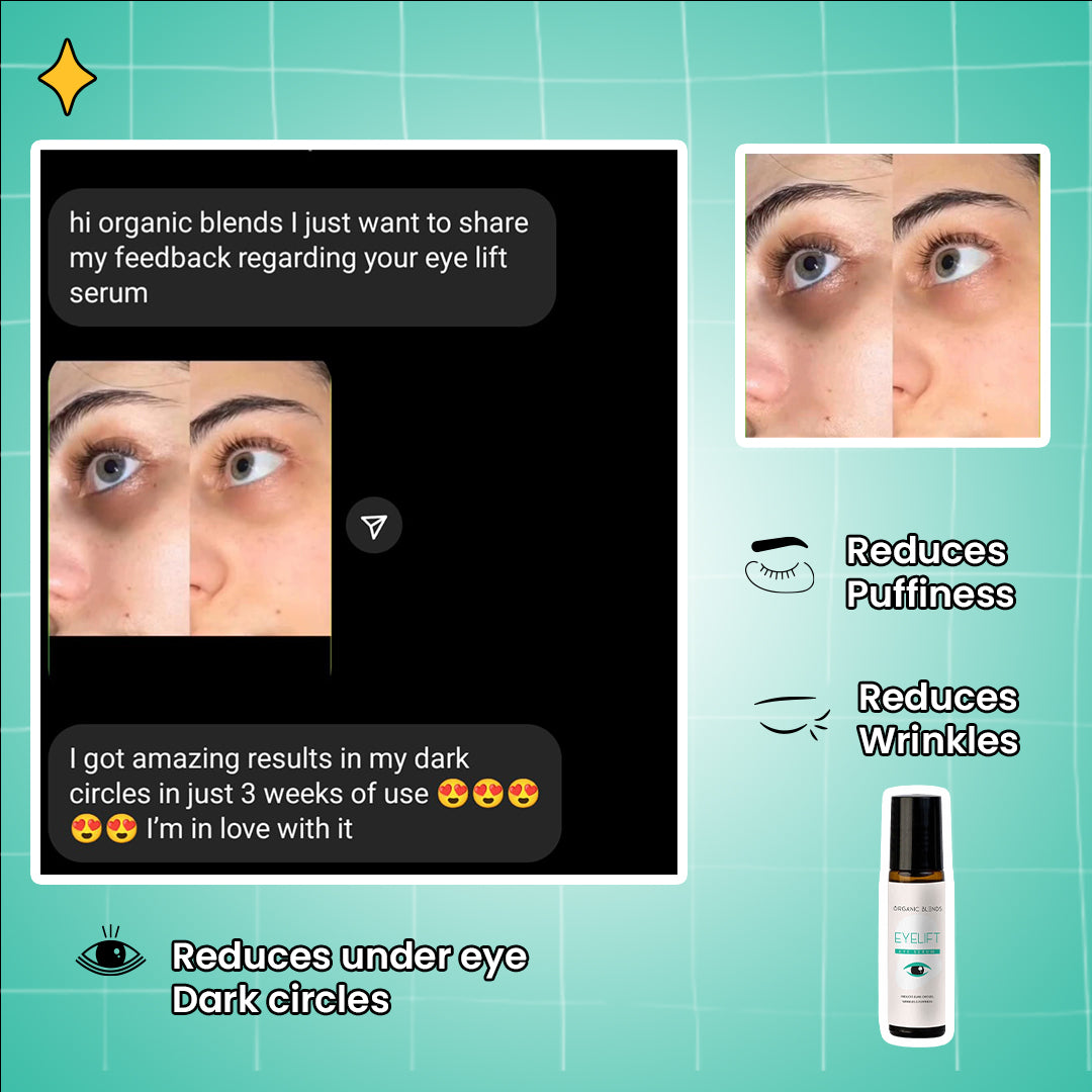 EYELIFT Eye Serum | Reduces Dark Circles In 2-Weeks